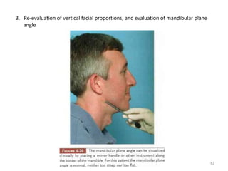 3. Re-evaluation of vertical facial proportions, and evaluation of mandibular plane
angle
82
 