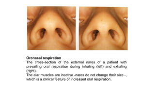 Orthodontic diagnostic procedures part 3 | PPTX