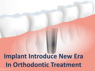 Implant Introduce New Era
In Orthodontic Treatment
 
