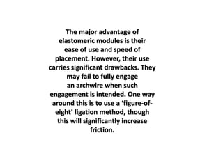 The major advantage of
elastomeric modules is their
ease of use and speed of
placement. However, their use
carries significant drawbacks. They
may fail to fully engage
an archwire when such
engagement is intended. One way
around this is to use a ‘figure-of-
eight’ ligation method, though
this will significantly increase
friction.
 