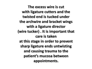 The excess wire is cut
with ligature cutters and the
twisted end is tucked under
the archwire and bracket wings
with a ligature director
(wire tucker) . It is important that
care is taken
at this stage in order to prevent
sharp ligature ends untwisting
and causing trauma to the
patient’s mucosa between
appointments.
 