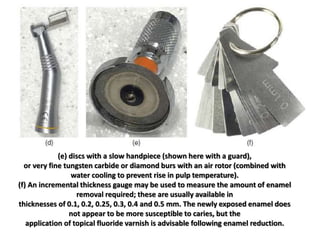 (e) discs with a slow handpiece (shown here with a guard),
or very fine tungsten carbide or diamond burs with an air rotor (combined with
water cooling to prevent rise in pulp temperature).
(f) An incremental thickness gauge may be used to measure the amount of enamel
removal required; these are usually available in
thicknesses of 0.1, 0.2, 0.25, 0.3, 0.4 and 0.5 mm. The newly exposed enamel does
not appear to be more susceptible to caries, but the
application of topical fluoride varnish is advisable following enamel reduction.
 