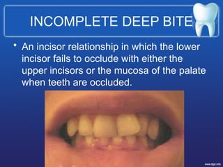 Orthodontic MANAGEMENT OF DEEP BITE.pptx