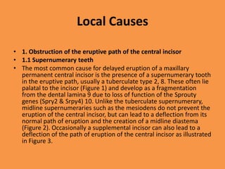 Local Causes
• 1. Obstruction of the eruptive path of the central incisor
• 1.1 Supernumerary teeth
• The most common cause for delayed eruption of a maxillary
permanent central incisor is the presence of a supernumerary tooth
in the eruptive path, usually a tuberculate type 2, 8. These often lie
palatal to the incisor (Figure 1) and develop as a fragmentation
from the dental lamina 9 due to loss of function of the Sprouty
genes (Spry2 & Srpy4) 10. Unlike the tuberculate supernumerary,
midline supernumeraries such as the mesiodens do not prevent the
eruption of the central incisor, but can lead to a deflection from its
normal path of eruption and the creation of a midline diastema
(Figure 2). Occasionally a supplemental incisor can also lead to a
deflection of the path of eruption of the central incisor as illustrated
in Figure 3.
 