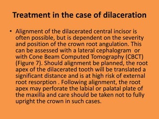 Treatment in the case of dilaceration
• Alignment of the dilacerated central incisor is
often possible, but is dependent on the severity
and position of the crown root angulation. This
can be assessed with a lateral cephalogram or
with Cone Beam Computed Tomography (CBCT)
(Figure 7). Should alignment be planned, the root
apex of the dilacerated tooth will be translated a
significant distance and is at high risk of external
root resorption . Following alignment, the root
apex may perforate the labial or palatal plate of
the maxilla and care should be taken not to fully
upright the crown in such cases.
 
