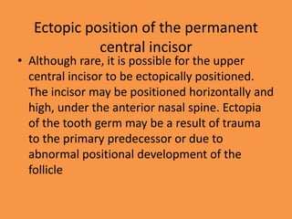 Ectopic position of the permanent
central incisor
• Although rare, it is possible for the upper
central incisor to be ectopically positioned.
The incisor may be positioned horizontally and
high, under the anterior nasal spine. Ectopia
of the tooth germ may be a result of trauma
to the primary predecessor or due to
abnormal positional development of the
follicle
 
