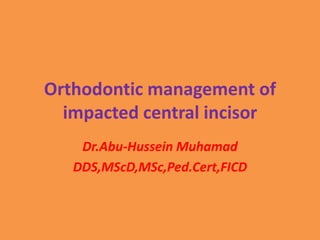 Orthodontic management of
impacted central incisor
Dr.Abu-Hussein Muhamad
DDS,MScD,MSc,Ped.Cert,FICD
 