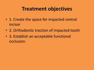Treatment objectives
• 1. Create the space for impacted central
incisor
• 2. Orthodontic traction of impacted tooth
• 3. Establish an acceptable functional
occlusion.
 