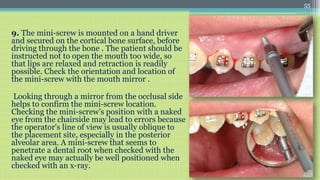 Mini Screw Invisalign Orthodontic mini implant | PPTX