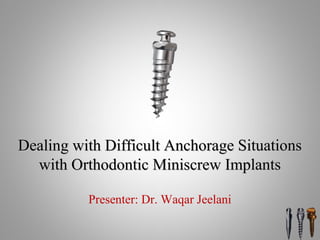 Dealing with Difficult Anchorage SituationsDealing with Difficult Anchorage Situations
with Orthodontic Miniscrew Implantswith Orthodontic Miniscrew Implants
Presenter: Dr. Waqar Jeelani
 