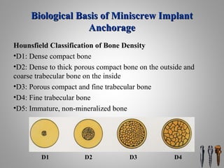 Biological Basis of Miniscrew ImplantBiological Basis of Miniscrew Implant
AnchorageAnchorage
Hounsfield Classification of Bone Density
•D1: Dense compact bone
•D2: Dense to thick porous compact bone on the outside and
coarse trabecular bone on the inside
•D3: Porous compact and fine trabecular bone
•D4: Fine trabecular bone
•D5: Immature, non-mineralized bone
D1 D2 D3 D4
 