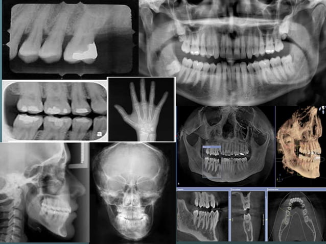 Orthodontic radiograph.. | PPTX