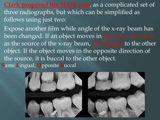 Using Slob Rule Radiograph Orthodontic radiograph.. | PPTX