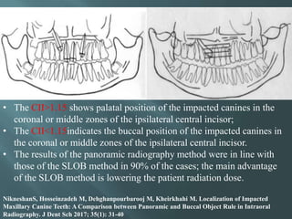 Using Slob Rule Radiograph Orthodontic radiograph.. | PPTX
