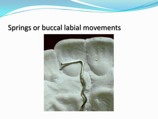 Springs or buccal labial movements
 