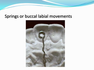 Springs or buccal labial movements
 