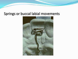 Springs or buccal labial movements
 