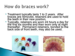  Treatment typically lasts 1 to 2 years. After
braces are removed, retainers are used to hold
the teeth in their new position.
 Typically, retainers are worn 24 hours a day for
the first six months and then worn only at night
thereafter. Permanent retainers, bonded to the
back side of front teeth, may also be used.
 