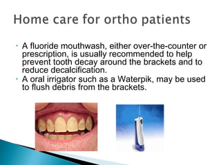 • A fluoride mouthwash, either over-the-counter or
prescription, is usually recommended to help
prevent tooth decay around the brackets and to
reduce decalcification.
• A oral irrigator such as a Waterpik, may be used
to flush debris from the brackets.
 