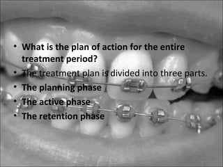 • What is the plan of action for the entire
treatment period?
• The treatment plan is divided into three parts.
• The planning phase
• The active phase
• The retention phase
 