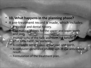 • 10. What happens in the planning phase?
• A pre-treatment record is made, which includes:
– A medical and dental history.
– The making of casts for the upper and lower teeth
and jaws.
– Photographs of the face and teeth for before and
after treatment comparisons.
– A complete set of x-rays of the jaws and teeth.
– A computer-generated photograph of the anticipated
result.
– Formulation of the treatment plan.
 