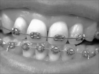 Orthodontics