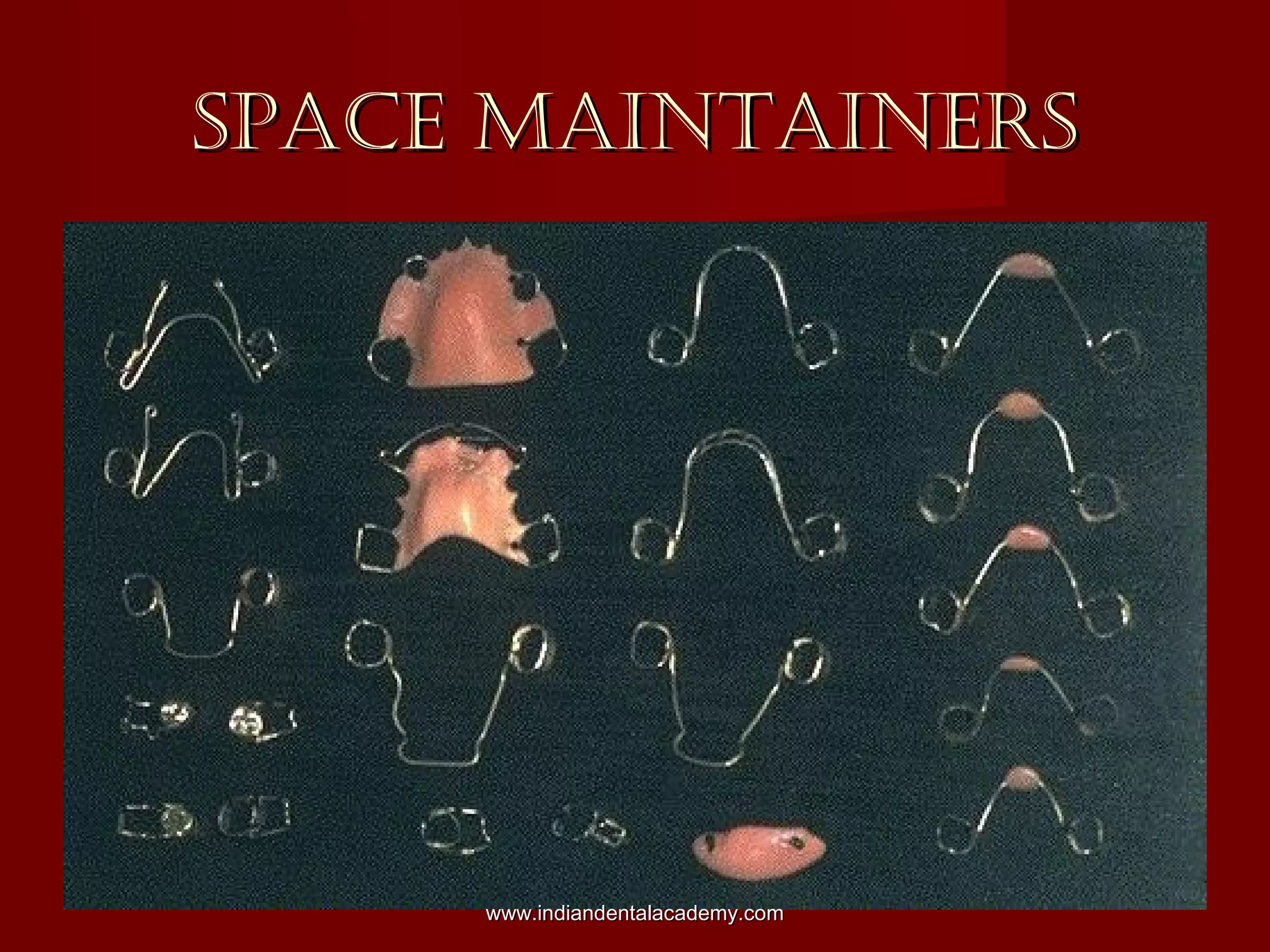 SPACE MAINTAINERSSPACE MAINTAINERS
www.indiandentalacademy.comwww.indiandentalacademy.com
 
