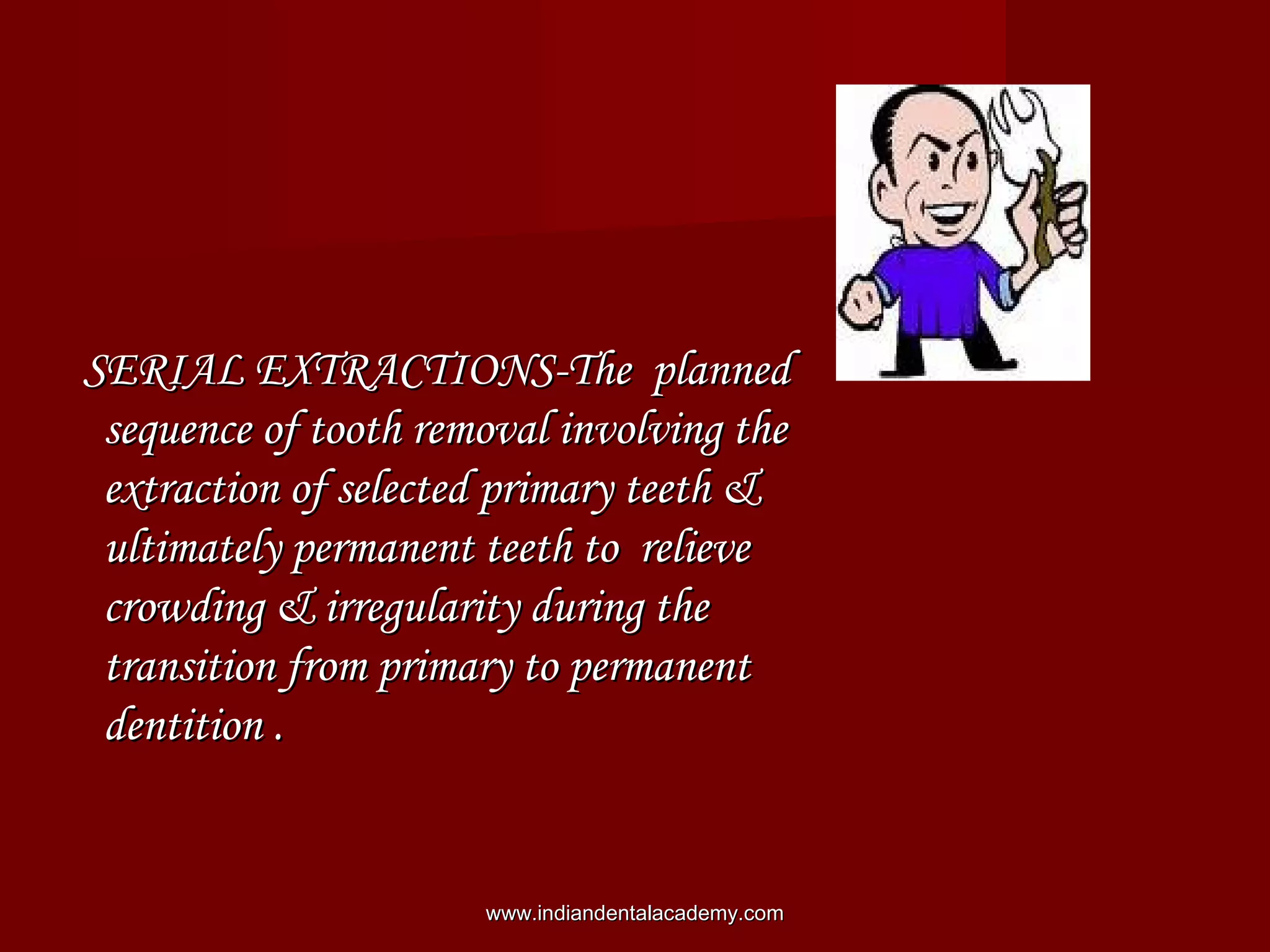 SERIAL EXTRACTIONS-The plannedSERIAL EXTRACTIONS-The planned
sequence of tooth removal involving thesequence of tooth removal involving the
extraction of selected primary teeth &extraction of selected primary teeth &
ultimately permanent teeth to relieveultimately permanent teeth to relieve
crowding & irregularity during thecrowding & irregularity during the
transition from primary to permanenttransition from primary to permanent
dentition .dentition .
www.indiandentalacademy.comwww.indiandentalacademy.com
 