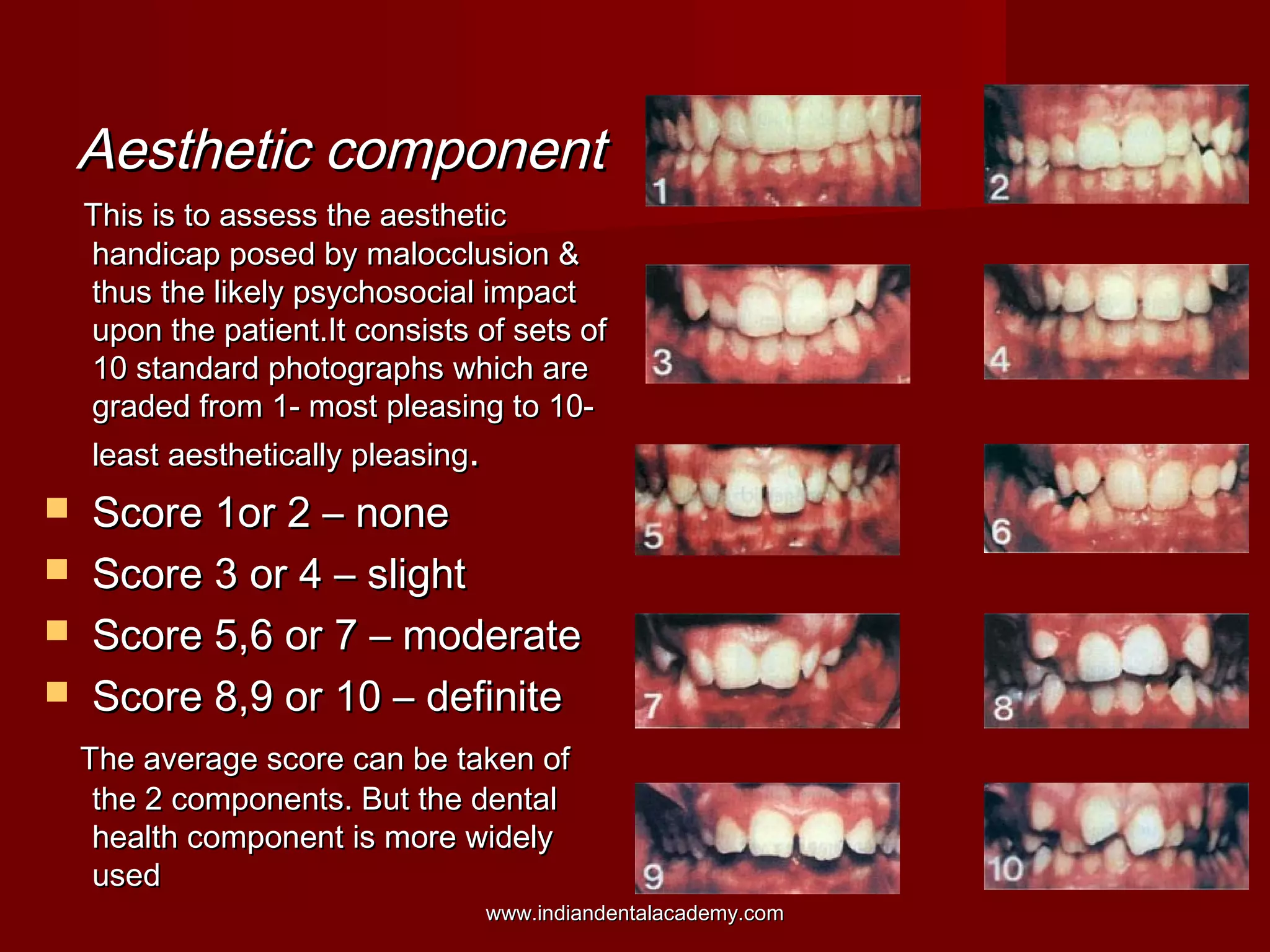 Aesthetic componentAesthetic component
This is to assess the aestheticThis is to assess the aesthetic
handicap posed by malocclusion &handicap posed by malocclusion &
thus the likely psychosocial impactthus the likely psychosocial impact
upon the patient.It consists of sets ofupon the patient.It consists of sets of
10 standard photographs which are10 standard photographs which are
graded from 1- most pleasing to 10-graded from 1- most pleasing to 10-
least aesthetically pleasingleast aesthetically pleasing..
 Score 1or 2 – noneScore 1or 2 – none
 Score 3 or 4 – slightScore 3 or 4 – slight
 Score 5,6 or 7 – moderateScore 5,6 or 7 – moderate
 Score 8,9 or 10 – definiteScore 8,9 or 10 – definite
The average score can be taken ofThe average score can be taken of
the 2 components. But the dentalthe 2 components. But the dental
health component is more widelyhealth component is more widely
usedused
www.indiandentalacademy.comwww.indiandentalacademy.com
 