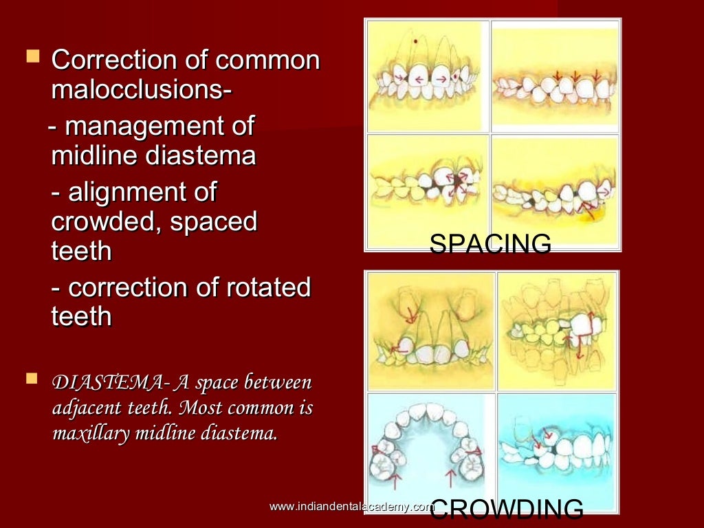 Orthodontics scope & introduction
