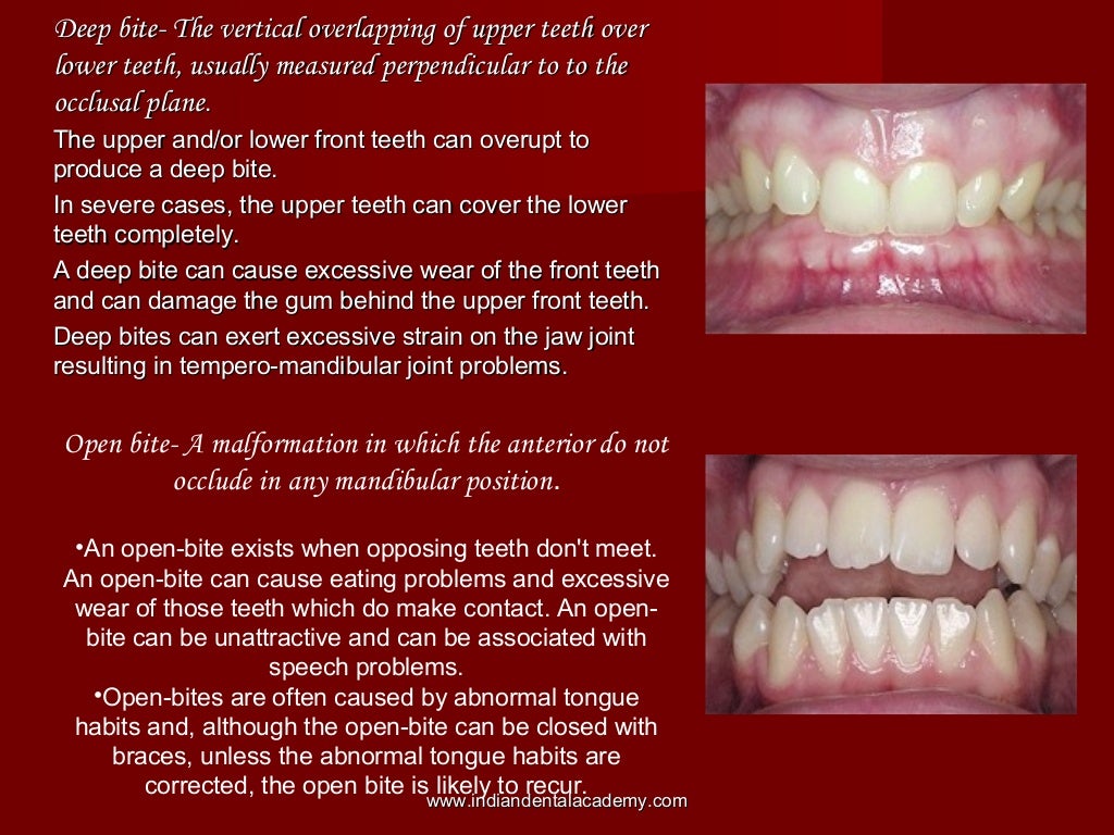 Orthodontics scope & introduction
