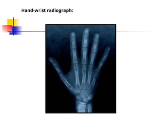 Comprehensive Guide to Skeletal Maturity and Hand-Wrist Radiographic ...
