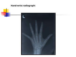 Comprehensive Guide to Skeletal Maturity and Hand-Wrist Radiographic ...
