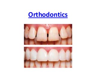 Orthodontics

 