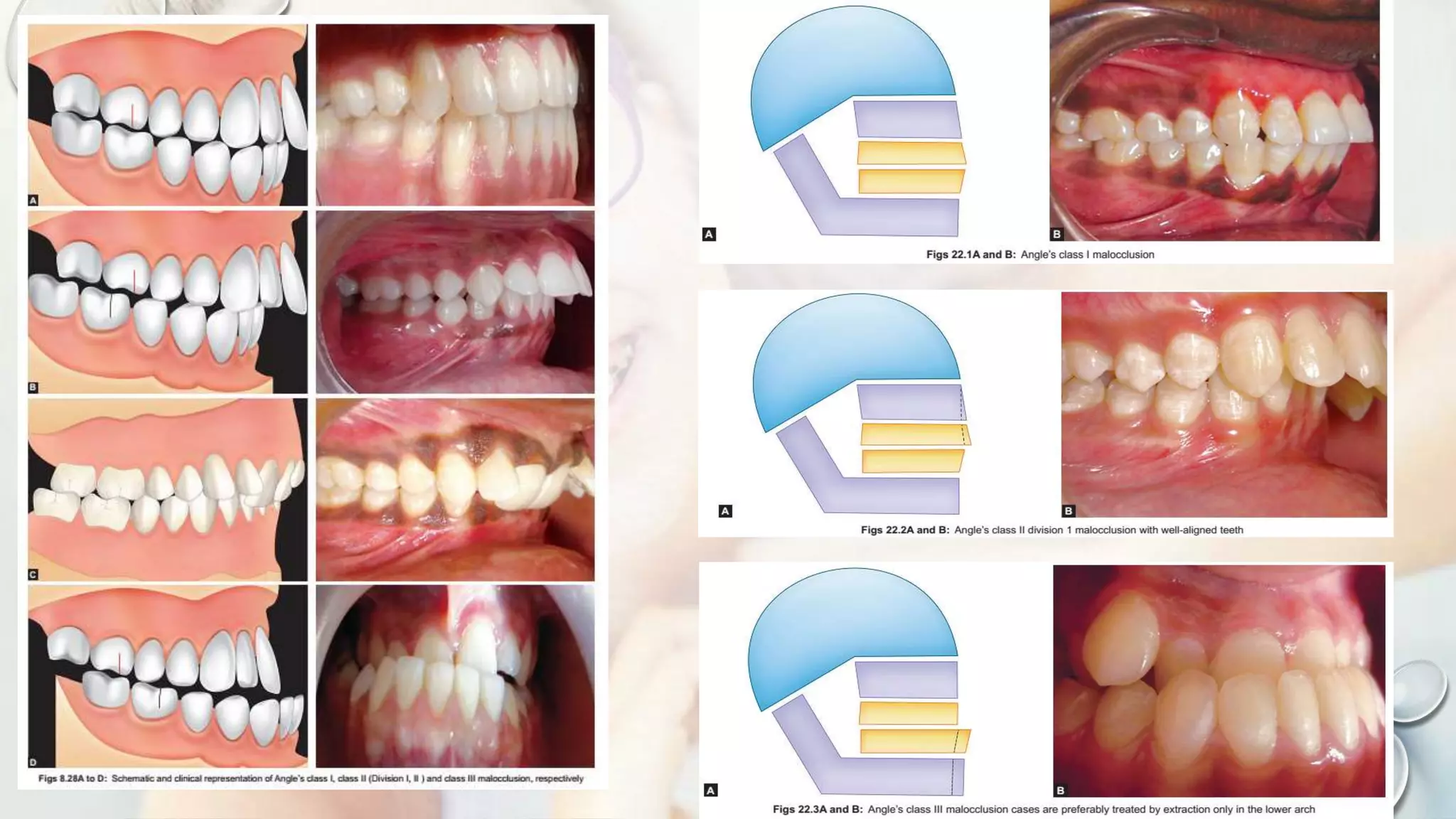 Orthodontics At A Glance.pptx