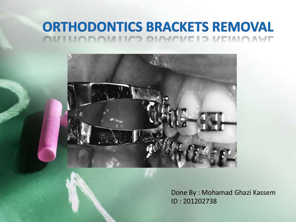 Orthodontics brackets removal
