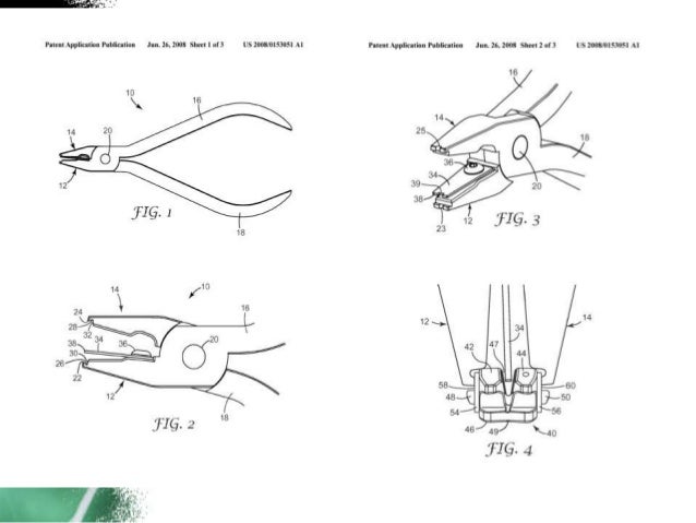 orthodontics-brackets-removal