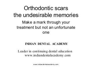 Orthodontic scars
the undesirable memories
Make a mark through your
treatment but not an unfortunate
one
www.indiandentalacademy.com
INDIAN DENTAL ACADEMY
Leader in continuing dental education
www.indiandentalacademy.com
 