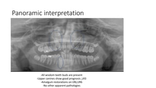 Lr6 Tooth Orthodontics case presentation by dr noor haddadin | PPTX
