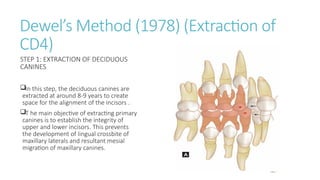 ORTHODONTIC SERIAL EXRTACTION .pptx