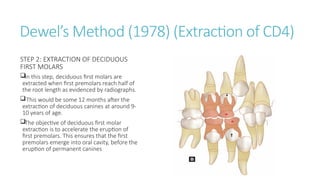 ORTHODONTIC SERIAL EXRTACTION .pptx