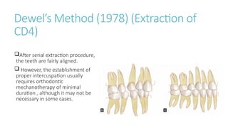 ORTHODONTIC SERIAL EXRTACTION .pptx
