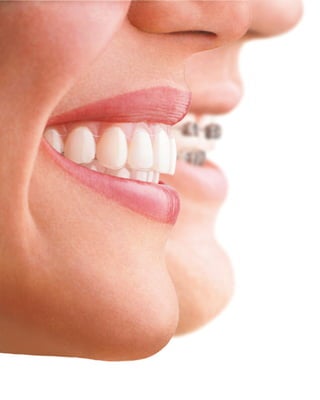 Orthodontics in sydney