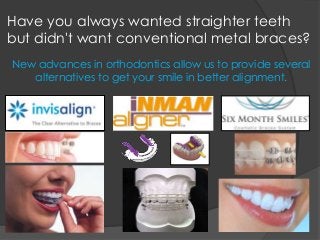 Have you always wanted straighter teeth
but didn't want conventional metal braces?
New advances in orthodontics allow us to provide several
alternatives to get your smile in better alignment.
 