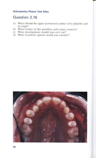 Orthodontics Picture Test Atlas.pdf