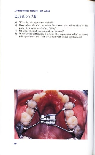 Orthodontics Picture Test Atlas.pdf