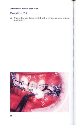 Orthodontics Picture Test Atlas.pdf