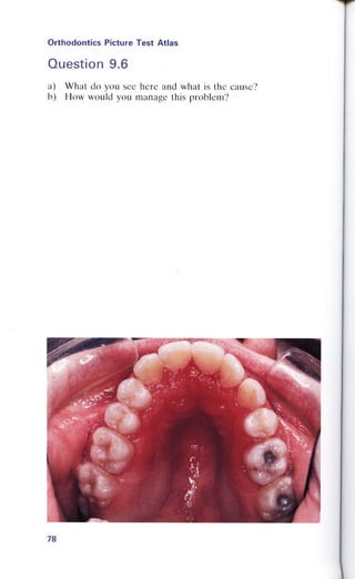 Orthodontics Picture Test Atlas.pdf