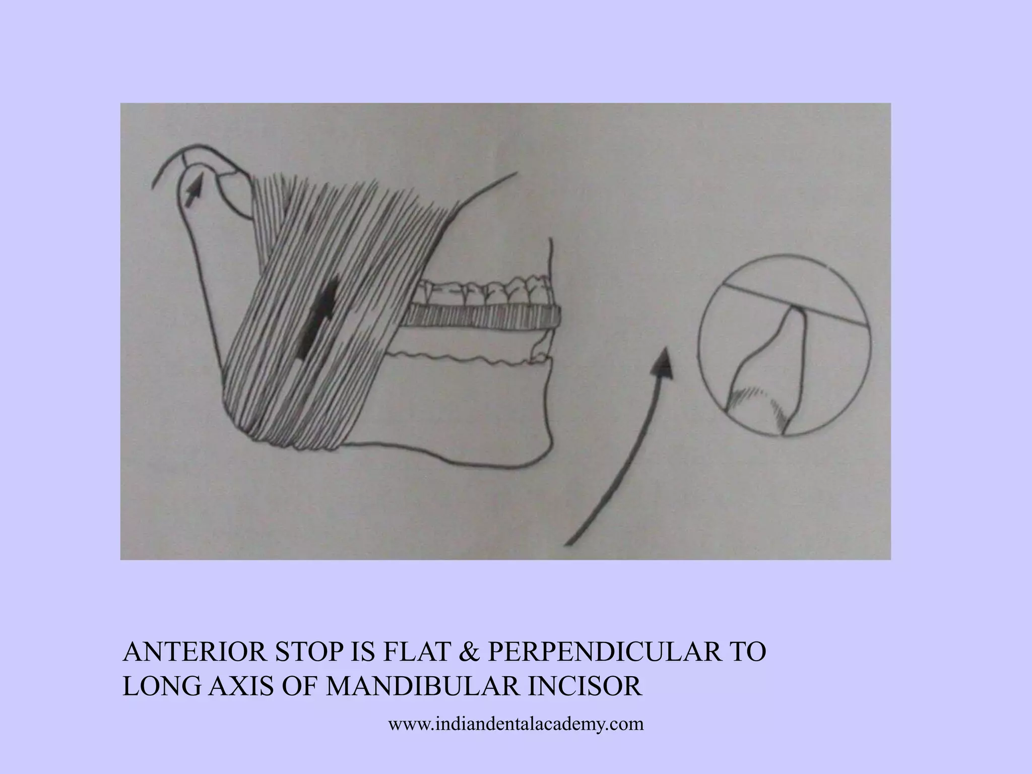 ANTERIOR STOP IS FLAT & PERPENDICULAR TO
LONG AXIS OF MANDIBULAR INCISOR
www.indiandentalacademy.com

 
