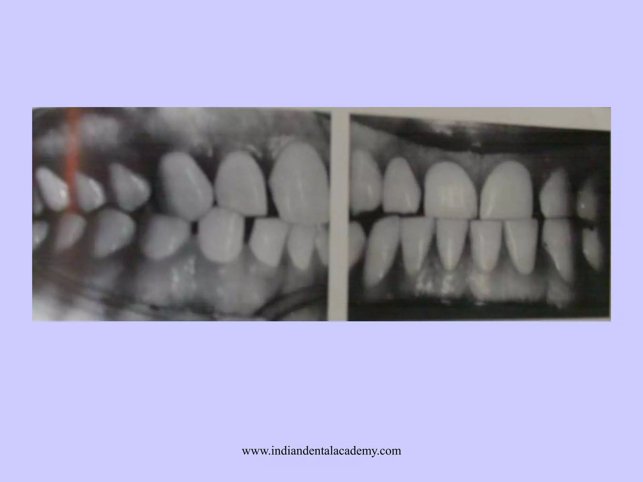 www.indiandentalacademy.com

 